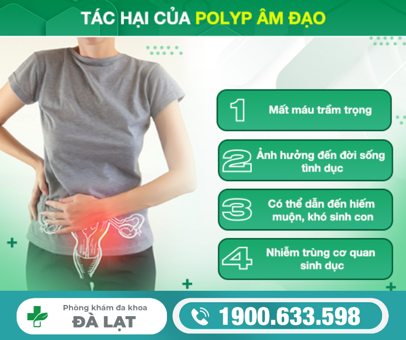 Hình ảnh minh họa